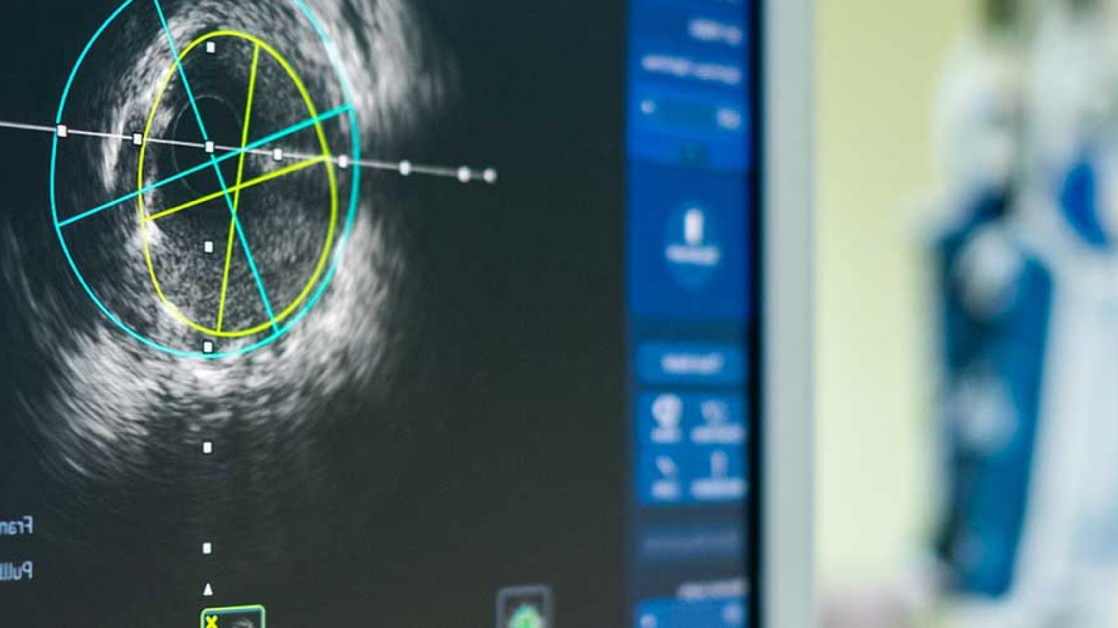 Electrophysiology and Pacing